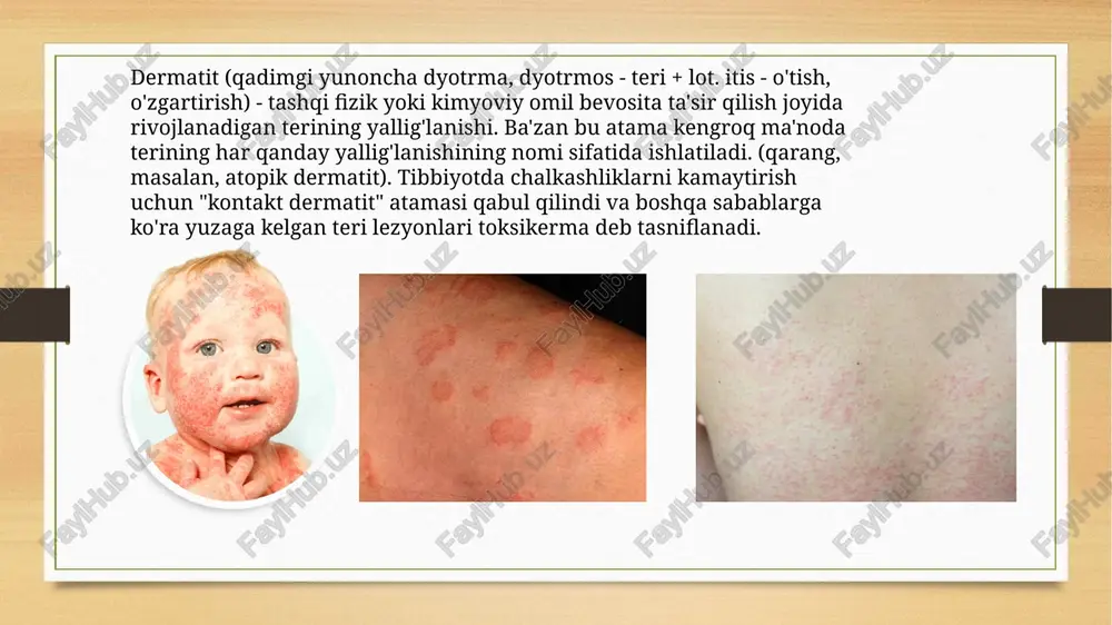 ni almashtiring. temperatura qilayotgan bemorlarda ishtaha odatda pasayadi, shuning uchun yengil parxez buyiriladi. oziq-ovqatning kunlik kaloriya miqdori saqlanishi kerak hayotning ikkinchi yarmidagi bolalarda go'sht mahsulotlari vaqtincha sut mahsulotlari bilan almashtiriladi. ratsionda osh tuzi cheklangan, bu diurezning kuchayishiga olib keladi parxez image5.png image6.png image7.png image8.png image9.png image10.png image11.png image12.png image13.png image14.png image15.png image16.png image17.png image18.png image19.png image20.png image21.png image22.png image23.png image24.png image3.png image4.png /docprops/thumbnail.jpeg