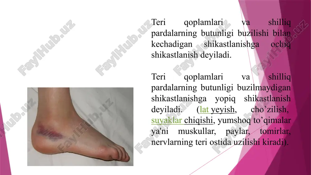 tadbirlarini olib borishdan iborat xulosa. qorinnig yopiq shikastlanishlarida bemorlarda qorin bo'shlig'i gipertenziyasi sindromini rivojlanishini shubxa qilinganda o'z vaqtida qorin ichki bosimi darajasini monitoringni kuzatish kerak bo’ladi. qorin bo'shlig'ining qo'shma shikastlanishlarida qorin bo'shlig'i gipertenziyasi sindromini rivojlanishi o'lim ko'rsatkichlarini yuqoriligi bilan xarakterlanadi. qorin perfuzion bosim ko'rsatgichlarini oshishi organlar faoliyatini yetishmovchiligi va og'ir holatdagi bemorlarda ahvolini o'rtacha og'irlik darajasini statistik jihatdan korrelyatsiya qilishda muhim hisoblanadi. qorin bo'shlig'ini dekompressiya qilishga ko'rsatma qorin perfuzion bosim monitoringi asosida, organlar faoliyatini etishmovchiligining rivojlanishining klinik ko'rinishini hisobga olgan holda amalga oshiriladi. manbalar 1. m. m. aliyev. andominal xirurgiya, 2018, toshkent — 158-160 bet. 2. m. m. aliyev. bolalar xirurgiyasi, 2018, toshkent: yangi nashr — 158-160 bet e’tiboringiz uchun raxmat! image1.jpeg image2.jpeg image3.jpeg image4.jpeg image5.jpeg image6.png image7.jpeg image8.jpeg image9.jpeg image10.jpeg image11.jpeg image12.jpeg image13.jpeg image14.jpeg image15.jpeg image16.jpeg image17.jpeg image18.jpeg image19.jpeg image20.jpeg image21.jpeg image22.jpeg image23.jpeg image24.jpeg image25.jpeg image26.jpeg image27.png image28.jpeg /docprops/thumbnail.jpeg