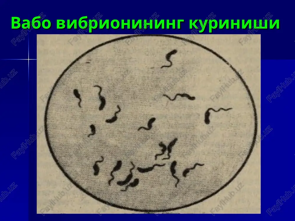 . miya shishi, gipoglikemiya, upka shishi. ichak parezi (kupincha yosh bolalarda). ayollarda xomila tashlash, yuldoshni ajralishini chuzilishi. ayrim xollarda pirogen reaktsiya kuzatilishi. okibati uz vaktida tugri tashxis kuyib adekvat muolaja olib borilsa, 93-99% xollarda sogayish bilan; 1-7% xollarda ulim bilan yakunlanadi. davolash vaboga duchor bulgan bemor engil va urtacha ogirlikda bulsa 1 soat davomida ichishi lozim bulgan eritmaning mikdori kuyidagi formula orkali xisoblanadi: v=p x ii/6 x 10=ml/s v – 1 soat davomida bemor ichishi lozim bulgan eritma mikdori, ml xisobida; p – bemor tanasining ogirligi, kg; ii – suvsizlanish darajasi, %; 10 – koeffitsent. birlmachi regidratatsion muolaja davrida bemorning kayt kilish va najas bilan yukotayotgan xamda kabul kilayotgan eritmasining mikdori anik xisobga olinadi va reanimatsion varakaga kayd kilinadi. regidratatsiya davrida asosan fillipsni №1 eritmasi isitilgan (38,0-40,0˚s) xolda minutiga 100-120 ml tezlikda tomirdan yuboriladi. eritmani lozim bulgan xajmi fillips formulasi buyicha xisoblanadi: v = 4 x 10³ x (d-1,025) x …