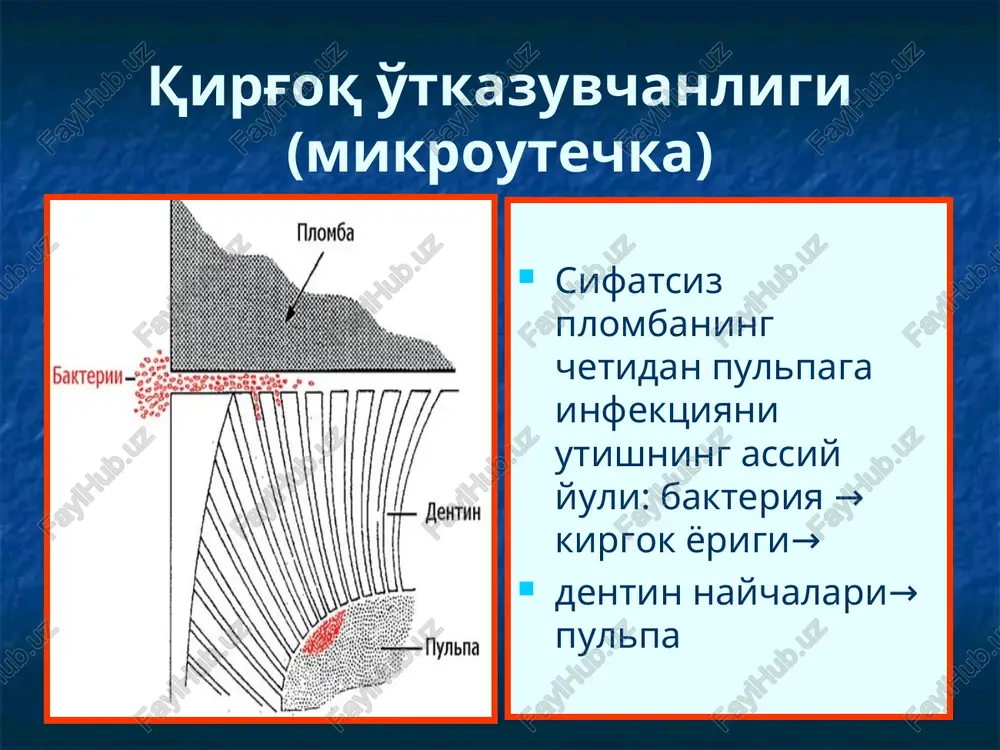 dentin curunkali fibroz pulpitda pulpadagi uzgarish pulpa kamerasini karioz bushlik bilan alokasi mavjud emas kon tomirlar kamaygan xujayra elementlari kollagen tolalarga fibroz uzgarishli transformatsiyasi va odontoblastlar vakuol distrofiyasi bilan buladigan reaktiv uzgarish ildiz pulpasida sezilarsiz uzgarish surunkali fibroz pulpit. x 80. 1 – odontoblastlar qatlami siyraklashgan; 2 – kollagen tolalar fibrozi 3 – tomir devori gialinozi. mikrofotogramma. gematoksilin va eozin bo'yog'i. katta.: hajm. 9, ok. 10 surunkali fibroz pulpit. surunkali gangrenoz pulpit ob'ektiv kurik eod: 60-80 mka perkussiya: vertikal va gorizontal kam ogrikli termodiagnostika: sovukka ogriksiz, isikka davomli ogrik zondlash: karioz kavak tish bushligi bilan tutashgan, chukur zondlash ogrikli zondlash: chukur karioz kavak, yumshagan dentin surunkali gangrenoz pulpit karioz bushlik tish bushligi bilan tutashgan, uning yuzasida patologik granulyatsion tukima xosil buladi (strelka), kaysiki sog tukimani kasal tukimadan ajratib turadi. persistent infektsiya xisobiga tukima uzluksiz ravishda apikal yunalishda suriladi: apikal → ildiz pulpiti → chukki periodontit. surunkali yiringli pulpit sklerozlangan pulpa …