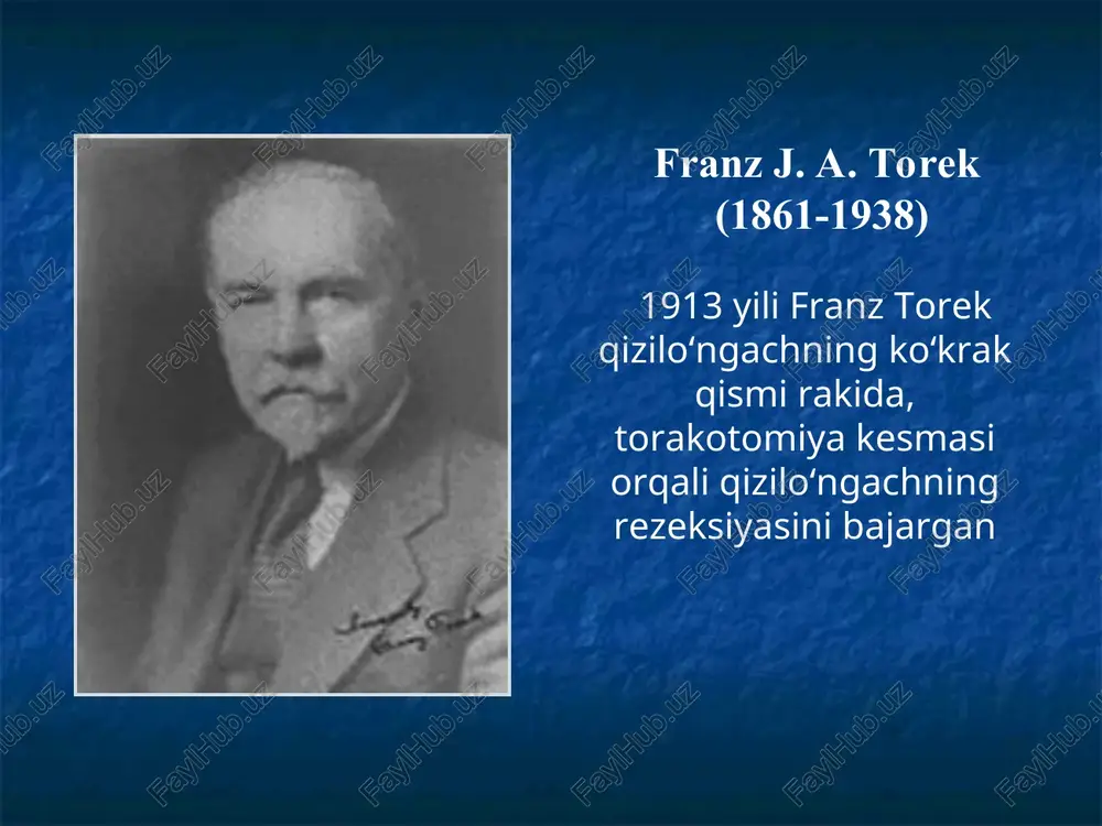 otilin va boshqalar) regulyasiyasini birlamchi buzilishi ii. ikkilamchi diafragma qizilo‘ngach teshigi churralarida, privratnik stenozida, oshqozon yara kasalligida, xoletsistitda, qorin bo‘shlig‘i katta xajmli o‘smalarda, assitda, xomiladorlikda, oshqozon rezeksiyasidan so‘ng, sklerodermiyada va boshqalarda iii. og‘irlik darajasiga qarab (savari va miller endoskopik klassifikatsiyasi, 1978) kardiospazm davrlari (b.v. petrovskiy) i davr – kardiyani funksional doimiy bo‘lmagan spazmi, qizilo‘ngach kengayishi kuzatilmaydi ii davr – kardiyani stabil spazmi, qizilo‘ngach keskin bo‘lmagan kengayishi bilan iii davr – kardiya mushak qavatining chandiqli o‘zgarishi, qizilo‘ngach keskin kengayishi bilan iv davr – kardiya keskin stenozi, qizilo‘ngach dilyatatsiyasi (ko‘pincha s-simon), ezofagit belgilari bilan kardiospazm ii bosqich iii bosqich iv bosqich kardiospazmni davolash usullari nissen operatsiyasi kardiospazmni davolash usullari qizilo‘ngach axalaziyasi axalaziyada qizilo‘ngach shaklining o‘zgarishi qizilo‘ngach axalaziyasi uchun xos bo‘lgan belgilar disfagiya regurgitatsiya og‘riq (og‘riqlar ovqat qabul qilish bilan bog‘liq bo‘lmaydi), paresteziyalar, qichishishlar ko‘ngil aynishi, qayd qilish, ozib ketish asoratlari (ezofagit, malignizatsiya, nafas olishni buzilishi) qizilo‘ngach xavfsiz o‘smasi qizilo‘ngach xavfsiz o‘smasini olib …