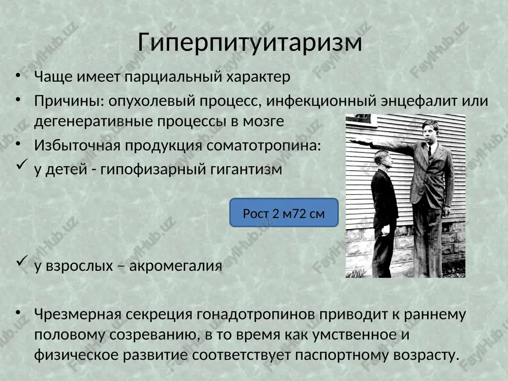 z giperparatireoz prichini: giperplaziya i opuxolevoe porajenie pshj virajennaya mishechnaya slabost, boli v mishtsax i kostyax, usilivayushiesya pri dvijenii, zapor, toshnota, rvota, poliuriya, polidipsiya, izostenuriya. sistemniy osteoporoz, neredki perelomi kostey pri rentgenologicheskom issledovanii v kostyax obnarujivayut uchastki razrejeniya v vide kist, a v myagkix tkanyax obrazovanie kaltsinatov povishaetsya videlenie kaltsiya s mochoy, snijaetsya soderjanie fosfora i uvelichivaetsya uroven kaltsiya v krovi ostraya nadpochechnikovaya nedostatochnost prichini: dvustoronnee povrejdenii kori nadpochechnikov ili krovoizliyanie v rezultate: rodovoy travmi tromboza ili embolii ven dvs-sindroma tyajelix infektsiy (meningokokkovaya), sepsisa stressov, bolshix operatsiy, ojogov lecheniya antikoagulyantami vnezapnogo prekrasheniya lecheniya kortikosteroidami - «sindrom otmeni» klinika ostroy nadpochechnikovoy nedostatochnosti tyajeloe sostoyanii bolnogo, rezkaya slabost, adinamiya, anoreksiya toshnota, rvota, bol v jivote, jidkiy stul odishka, tsianoz snijenie ad (sosudistiy kollaps), puls slabo proshupivaetsya gipertermiya vozmojni sudorogi, poterya soznaniya xronicheskaya nadpochechnikovaya nedostatochnost prichini: autoimmunniy protsess, pri kotorom obrazuyutsya antitela k tkani nadpochechnikov dvustoronniy tuberkulezniy protsess v nadpochechnikax infektsii (sifilis, gribkovie …