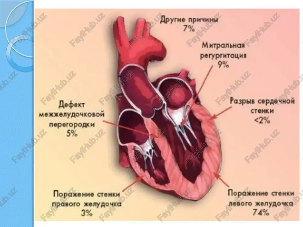 kardiogenshok klinikasi davolari - Page 5