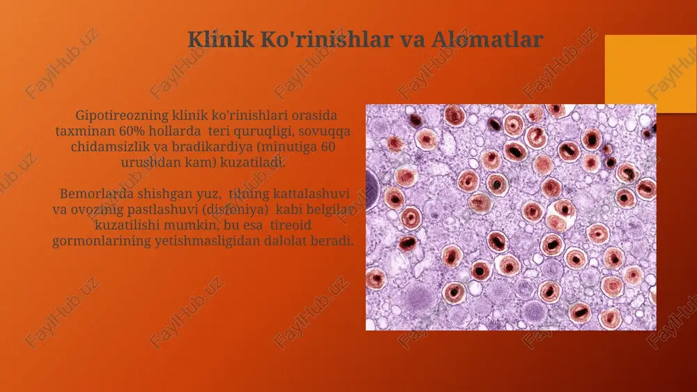 endemik buqoq va gipotireoz patoginezi - Page 5
