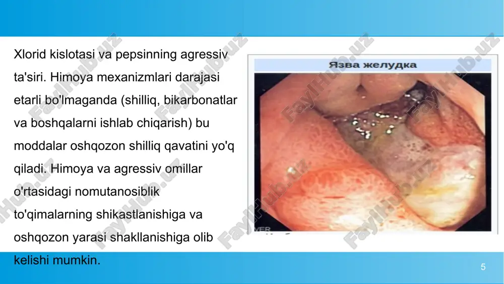 oshqozon yara kasalliklarini etiopotogenezi - Page 5
