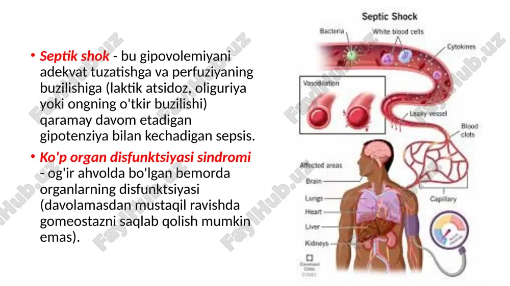 sepsis - Page 5