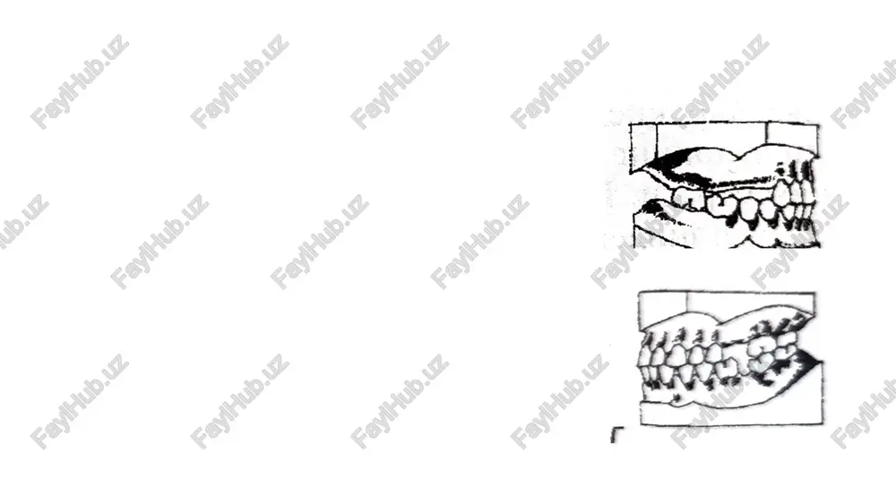 tish qatorlari deformatsiyalar - Page 5