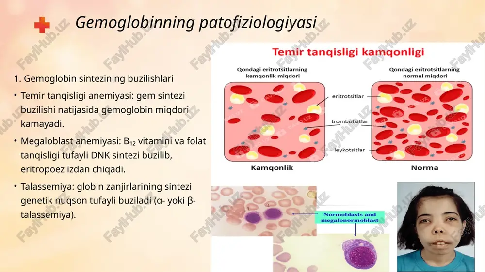 gemoglobinga oid patofiziologiya - Page 5