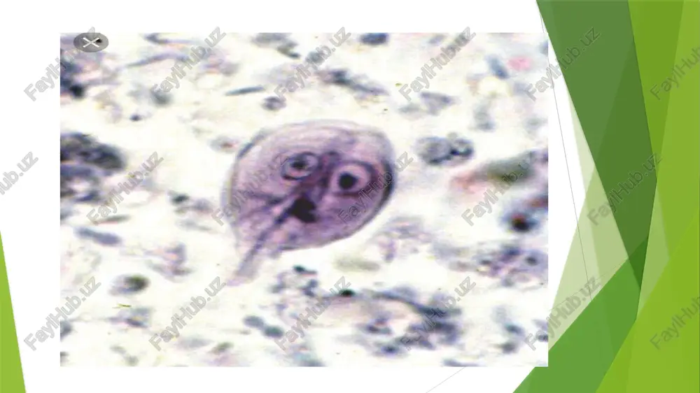 chilar bo’lgan honadonlarda va boshqa hollarda uchraydi kasallik patagenezi epidemik toshmali terlama kasalligiga o’hshash kasallikdan so’ng mikrobga va uning zahriga qarshi turg’un immunitet hosil bo;ladi qisman epidemik toshmali terlamaga ham immunited shakillanadi labaratoriya tashxisi hususiy diyagno’stikum bilan qo’yilgan aglutinatsiya reyaksiyasi o’tkaziladi bunda muzer antigeni bilan reyaksiyaning tipi poravachak antigeni bilan o’tkazilgan reyaksiya turiga nisbatan 3-4 barobar ortiq labaratoriya sharoitida keng qo’llanilgan va eng ishonchli usul komplementni bog’lash reyaksiyasi bunda komplementalni biriktiruvchi antitillolar bemor qonida kasalikning 6-7 kunidan boshlab aniqlanadi 14-16 kunga kelib titiri ortadi va kasallikning 20-27kunlarida eng yuqori darajaga yetadi epidemik toshmali terlamani endemik toshmali terlamadan farqlash uchun paravachak va muzer reketsiyalari antigenlari bilan strealogik testlar o’tkaziladi tamom image1.jpg image2.jpg image3.jpg image4.jpg image5.jpg image6.jpg image7.jpg image8.jpg image9.jpg /docprops/thumbnail.jpeg
