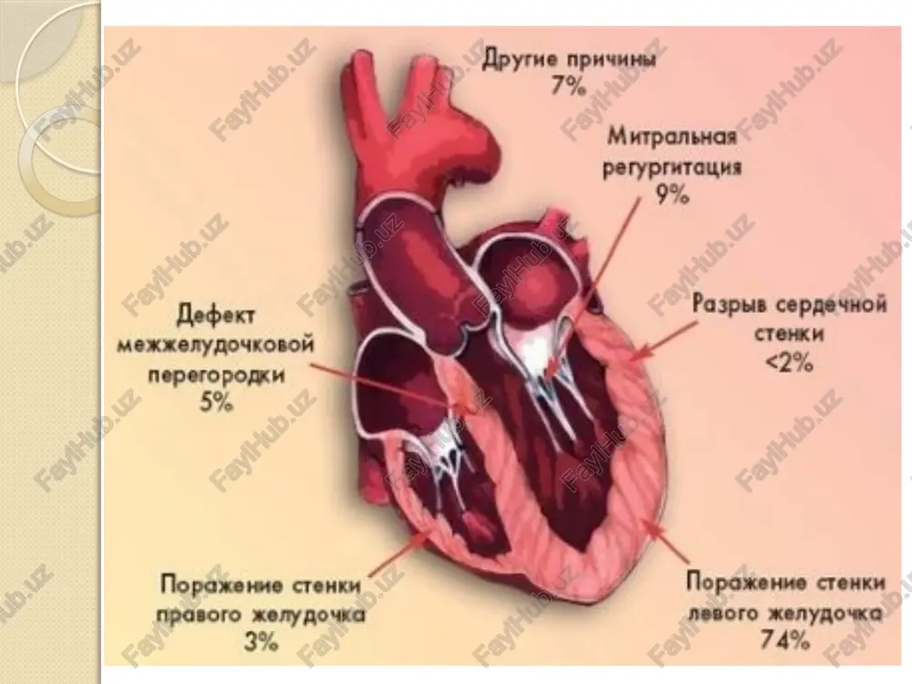 kardiogen shok klinikasi va davo choralari - Page 5