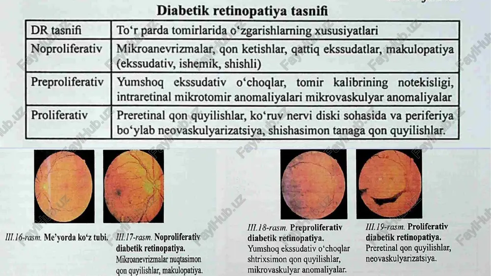 yurak innervatsiyasining parasimpatik innervatsiyasi yo’qolganda bu fenomen yo’qoladi’ yurak simpatik innervatsiyasi yetishmovchiligi 1shelong sinamasibemor 10 min yotadi qon bosimi o’lchanadi. keyin turadi va 2-4-6-8-10 daqiqalarda qon bosimi o’lchanadi 30 mm sim. ust dan pasayishi simpatik invning buzilishidan dalolat beradi. izotonik mushak sinamasi dastlab aqb o’lchanadi , keyin qo’lda 5min dinamometr bilan ishlanadi va aqb yana o’lchanadi agar diastolic bosim 10 mm sim .ustdan kam oshsa vegetative kardial neyropatiya davolash qdni yaxshi kompensatsiya qilish. insulinoterapiyani intensive qo’llash. bu periferik neyropatiyani 80%ga tushiradi alfa lipoy kislotasi krebs sikli fermentlari koenzimi bo’lganligi uchun krebs sikli tezlashadi va nerv hujayrasi uchun tiklanish energiyasini hosil qilib beradi b guruh vitaminlarini berish b1 glyukoza metobolizmini tartibga soladi va sorbid ( toksik) to’planishining oldini oladi. b12 myelin sintezi vaasab impulslarining o’tishini yaxshilaydi b6 (piridoksin) nerv mediatorlari (serotonin, dopamin, gaba) sintezida ishtirok etadi. bu og‘riq sezgilarini kamaytiradi va asab faoliyatini tiklaydi. foydalanilgan adabiyotlar b.shagazatova endokrinologiya chat gpt https://www.talkbass.com/threads/can-someone-switch-his-her-main-finger-after-a-while.1549132/ …