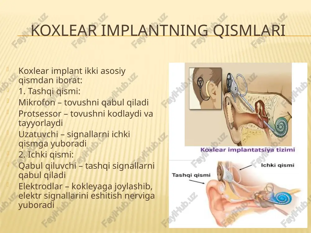 koxlear implant haqidamalumot - Page 5