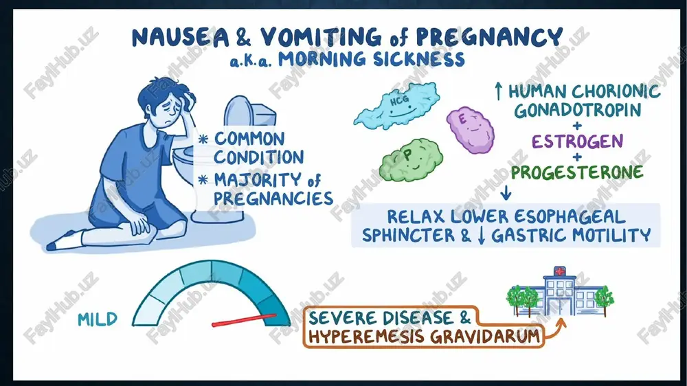 higa haftasida 1 marotaba yoki 1,5 mg ichishga sutkada 1 marotaba.  agar aktiv qon ketishi kabi qarshi ko‘rsatmalar bo‘lmasa, to‘xtovsiz qusgan ayollarga pastmolekular geparinlar tavsiya etilishi lozim. tromboprofilaktika uyiga javob berishdan oldin to‘xtatilishi mumkin.  infuzion terapiya: kunlik elektrolitlar monitoringi nazorati ostida, har bir flakonida kaliy xloridi mavjud bo‘lgan fiziologik eritma yoki poliion balanslangan kristaloidlar vena ichiga infuzion terapiya uchun eng to‘g‘ri keladigan deb hisoblanadi, agar natriyni zardobdagi miqdori me’yorida bo‘lmasa, dekstroza /glyukoza infuziyasi ishlatilmasligi kerak va infuziya tiamin yuborilishi bilan kuzatilishi shart. infuziya hajmi: 1000-3000 ml sutkada umumiy holatidan kelib chiqqan xolda. vena ichiga suyuqliklar yuborilishi lozim bo‘lgan hollarda plazmada mochevina va elekrolitlar miqdori har kuni tekshirilishi shart. infuzion terapiyaga talab bo‘lgan ayollarda giponatriemiya va gipokaliemiyani oldini olish va davolashda kunlik elektrolitlar monitoringi juda muhim. og‘ir/to‘xtamaydigan kaqq sindromining prognozi og‘ir darajali kaqq sindromida homiladorlikni to‘xtatishga ko‘rsatmalar  homiladorlikni to‘xtatishga qaror qilishdan avval barcha davolash tadbirlari sinab ko‘rilishi shart. …