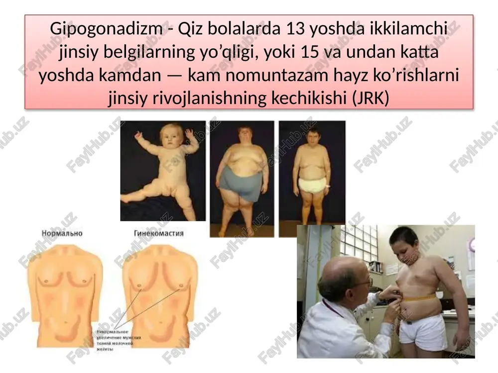 shereshevskiy – terner kasalligi - Page 5
