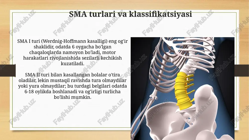 spinal mushak atrofiyasi - Page 5