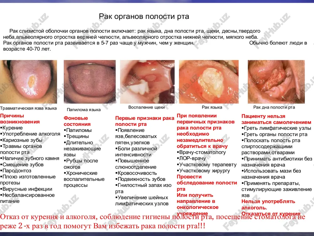 it na tri fazi ili perioda: nachalniy, razvitoy i period zapushennosti. nachalniy period. v eto vremya bolnie chashe vsego otmechayut neprivichnie oshusheniya v zone patologicheskogo ochaga. pri osmotre polosti rta mogut bit obnarujeni razlichnie izmeneniya: uplotnenie slizistoy obolochki, uplotnenie tkaney, poverxnostnie yazvi, papillyarnie novoobrazovaniya, belie pyatna i t.d. v etot period nujno tshatelno osmatrivat organi rotovoy polosti, tak kak analiz nablyudeniy pokazivaet, chto pochti 10% sluchaev pri pervix obrasheniyax k vrachu mestnie porajeniya na slizistoy obolochke ne bili viyavleni. boli, kotorie obichno zastavlyayut obrashatsya k vrachu, otmechayutsya v nachalniy period razvitiya raka primerno v 25% sluchaev. odnako bolee chem v 50% sluchaev boli svyazivayut s anginoy, zabolevaniem zubov i t.d. osobenno chasto eto nablyudaetsya pri rake s lokalizatsiey v zadney polovine polosti rta i alveolyarnogo kraya chelyusti. neredko vnimanie vrachey napravlyaetsya po lojnomu puti. v nachalniy period razvitiya raka organov polosti rta tselesoobrazno videlyat tri anatomicheskie formi: a) yazvennuyu; b)uzlovatuyu;v)papillyarnuyu. …