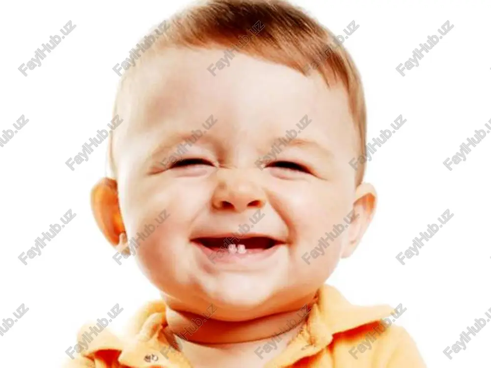 i shakli. sistemali emal gipoplaziyasida egatchalar gorizontal yo'nalishda joylashgan bo'lib, kesuv qirrasiga va chaynov yuzasiga nisbatan bir xil masofada parallel xolda yotadi. bunday nuqsonlar tish vestibulyar va lunj satxlarida yaxshi rivojlangan bo'ladi. mazkur egatchalar zondlanganda tubida og'riq sezilishi mumkin, barcha satxi silliq, zichligi yuqori bo'ladi. sistemali emal gipoplaziyasining likopchali shakli. mazkur nuqsonli xastalikda 6 tishlar do'mboqchalari, qoziq tishlar, ba'zan premolyar chaynov do'mboqchalari ingichkalashib o'tkir tikanak shaklini olishi yoki do'mboqchalar siyqalanib yo'qolib ketishi xususiy xol xisoblanadi. bunda emal to'qimasining yupqalashuvi faqat nuqsonli soxada, likopchalar tubidagina emas fissuralar soxasida xam sodir bo'ladi. ba'zi likopchalar tubida emal xaddan tashqari yupqalashgan yoki bo'lmasligi xam mumkin. shu joylarda karies jarayoni kechayotganligini guvoxi bo'lamiz. sistemali emal gipoplaziyasining aralash shakli. sistemali emal gipoplaziyasining aralash shakli emal to'qimasidagi almashinuv jarayonlar buzilishi oqibatida yuzaga kelishi mumkin bo'lgan barcha nuqsonlarni uz ichiga oladi. bu o'zgarishlar engil boskichda bo'lishi mumkin, o'rtacha og'irlikda va og'ir darajada bo'lishi mumkin. sistemali emal gipoplaziyasining aralash …