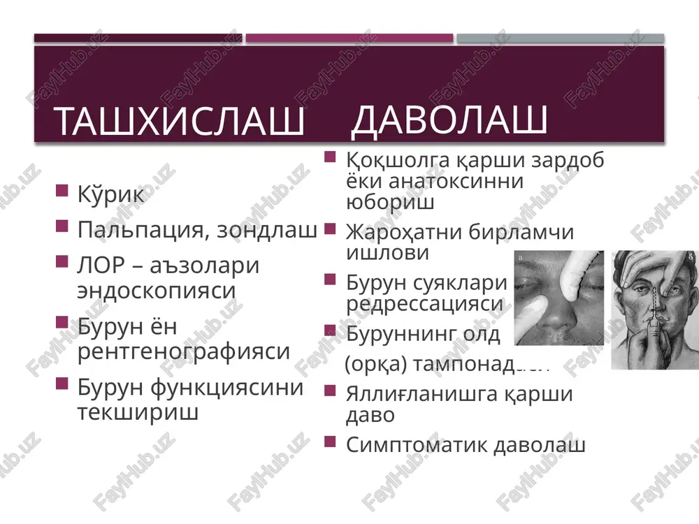 va b. ko'pincha meningokokk sil batsillalari (80-90%) somatik o'zgarishlar toshma yo'q tanada toshma, gerpes - ko'z tubidagi o'zgarishlar kam uchraydi bo'lishi mumkin kam uchraydi (40-50%) meningit qiyosiy tashxisoti bosh miya to'qimasi ho'ppozlari, ya'ni bosh miya to'qimasining chegaralangan yiringli to'plami o'rta quloq bo'shliqlarida yallig'lanish o'chog'i mavjud bo'lgan hollarda ikkilamchi jarayon sifatida rivojlanadi. bosh miya to'qimasi ho'ppozlari orasida bosh miya chakka bo'lagi va miyacha ho'ppozlari ayniksa ko'p uchraydi. miya va miyacha otogen abstsesslari miya va miyacha otogen abstsesslari tarqalishning asosiy yo'llari –kontakt yo'li, asosan bitta abstsess xosil bo'ladi. otogen abstsessni miyada joylashish o'rni – ko'pincha chakka soxasida va chakka – tepa soxasida. otogen miya abstsessi bosqichlari boshlang'ich 1-2 hafta davom etadi. latent 2-6 hafta davom etadi. yaqqol 2 hafta davom etadi. terminal boshlang'ich bosqichi bu bosqichda klinik belgilari kam bo'ladi. bemorda umumiy yallig'lanish jarayoniga xos umumiy belgilar (holsizlik, tana haroratini 37,2-37,50c ga ko'tarilishi) bilan birga bosh og'rig'i, ko'ngil aynishi, qusish kuzatiladi. bu …