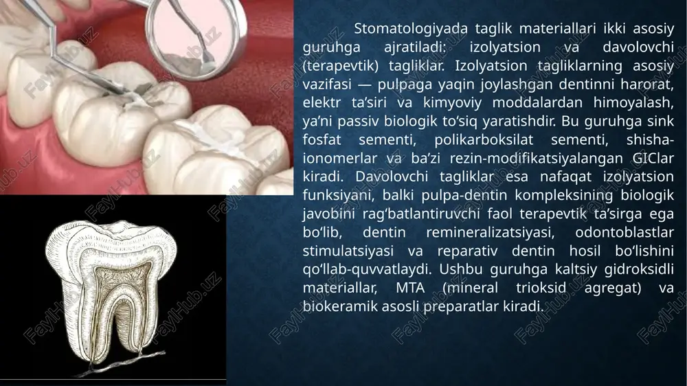 yordamida polimerizatsiyalanishi esa klinik ishlov berish jarayonini soddalashtiradi. xulosa stomatologiyada taglik materiallari nafaqat himoya vazifasini bajaradi, balki zamonaviy adgeziv sistemalar bilan integratsiyada muhim biologik va texnologik rol o‘ynaydi. izolyatsion tagliklar tish to‘qimalari va restavratsiya materiallari o‘rtasida barqaror interfeys hosil qilib, mikrosizlik va termik ta’sirlardan himoya qiladi. davolovchi bioaktiv tagliklar esa regenerativ stomatologiyada yangi bosqichni boshlab, pulpa-dentin kompleksini tiklashga xizmat qiladi. tagliklar bilan adgezivlar o‘rtasidagi muvofiqlik, klinik protokolga amal qilish va biomateriallarning to‘g‘ri tanlanishi sifatli, uzoq muddatli va biologik mos restavratsiyalarni ta’minlaydi. shu bois, har bir klinik holatda tagliklar strategik jihatdan puxta o‘ylangan va ilmiy asoslangan tarzda qo‘llanilishi lozim. foydalanilgan adabiyotlar: komilov h.p. stomatologik asbob va ashyolar. — toshkent, 2005. — 94 b. unilibrary.uz bahodirova r.n. va boshq. terapevtik stomatologiya. — (darslik, o‘zbek tilida). bsmi book bekjanova o.e., yusupalixodjayeva s.x., shukurova u.a., alimova d.m. klinik restavratsion stomatologiya. — toshkent, 2019. e-library sammu andijon davlat tibbiyot instituti. ortopedik stomatologiya propedevtikasi (o‘quv-uslubiy material). …