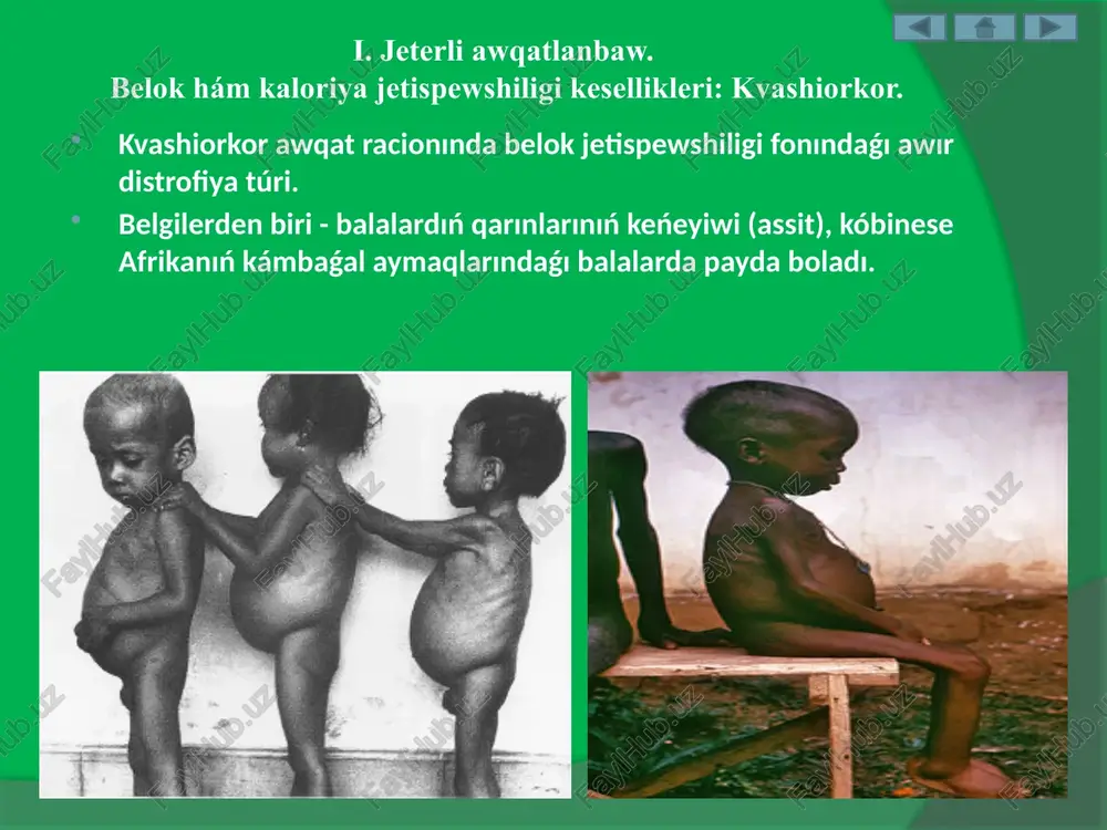 alimentarjetispewshiligihám aqıbetleri - Page 5