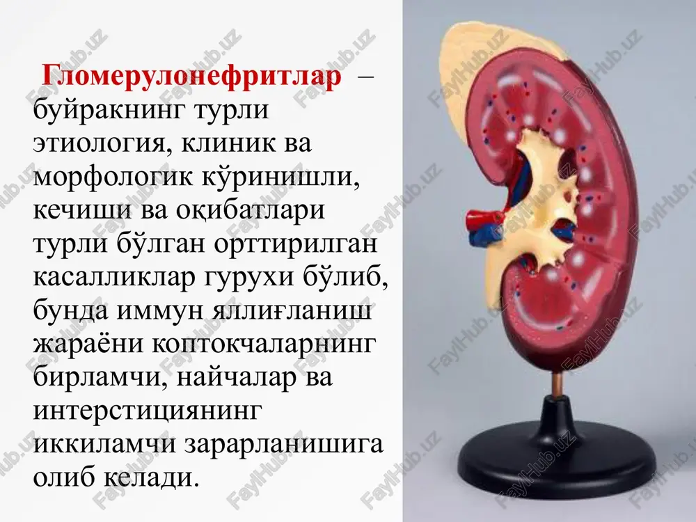 ngparligi, diurez -ning 200 —300 ml/sutkasiga kamayishi kuzatiladi. siydik loyqa, ba'zan go'sht seli rangida. aqb ortadi (130/80 - 150/90 mm rt. st.). ba'zida qorin va bel soxasida tushunarsiz og'riq, bosh og'rishi va qayt qilish kuzatiladi. keyingi 5-7 kunlarda ko'z tubidagi o'zgarishlarsiz giperten- ziya bo'ladi. bu davrda makrogematuriya bo'ladi. proteinuriya 0,5—3,5 g/sutkasigacha ortadi, ba'zi bemorlarda qisqa muddatli (3-5 kun) leykotsituriya (10-20 ml sutkasiga) va eritrotsi- tar tsilindrlar bo'ladi. buyrak kasalliklari klinikasida quyidagi sindromlar kuzatiladi: i. buyrak zararlanishining kichik sindromlari ii. buyrak zararlanishining katta sindromlari iii. nospetsifik belgilar «kichik sindromlar»: siydik sindromi arterial gipertenziya shish sindromi «katta sindromlar»: o'tkir nefritik nefrotik buyrak etishmovchiligi (o'tkir, surunkali) proteinuriya siydik sindromi: proteinuriya gematuriya tsilindruriya oliguriya. siydik sindromi - gematuriya: mikro - er. 20 – 25 ta ko'ruv maydonida, siydik rangi go'sht seli ko'rinishida - proteinuriya yaqqollik darajasiga ko'ra: qisman - 1 g/l gacha o'rtacha – 1-3 g/l massiv > 3 g/l xarakteriga ko'ra: selektiv – …