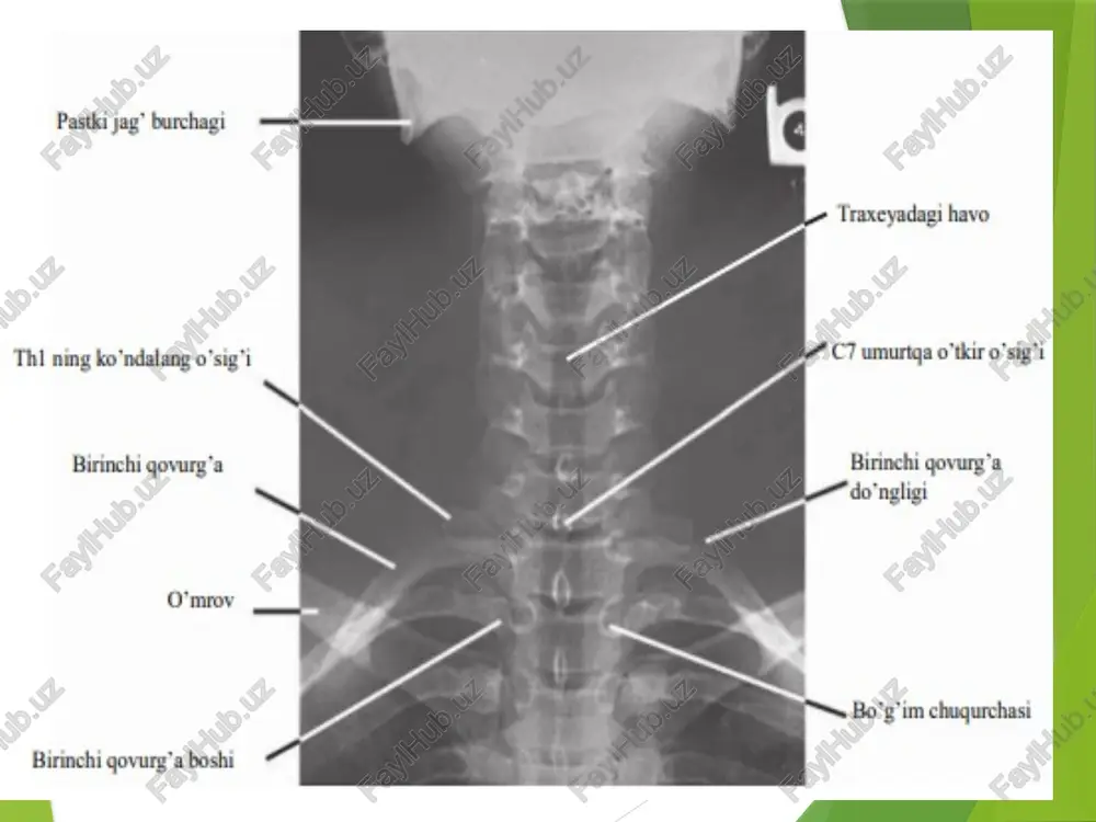 umurtqa pog’onasi anatomik tuzulishi va funksiyasi - Page 5