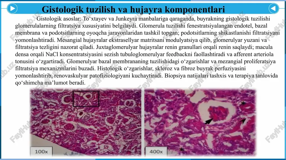 tizimini bloklovchi preparatlar (ace inhibitorlari yoki arb) renin-angiotenzin yo‘lini susaytirib qon bosimini kamaytiradi va baʼzi bemorlarda funktsiyani yaxshilashi mumkin, ammo boshlashda renal funksiyani diqqat bilan kuzatish zarur. diuretiklar va kalsiy kanal blokatorlari qo‘shimcha ravishda ishlatiladi. bemorning yosh, komorbid kasalliklari, bilateral yoki unilateral stenoz va buyrak funktsiyasi hisobga olinib dori tanlanadi va dozalar sozlanadi. agar funktsiya pasayishi yoki resistent gipertenziya bo‘lsa, revaskulyarizatsiya ko‘rib chiqiladi. dori terapiyasi endovaskulyar va jarrohlik usullar: revaskulyarizatsiya angioplastika va zarur bo‘lsa stent qo‘yishni o‘z ichiga oladi hamda renal arteriyaning lumenini tiklashga yo‘naltiriladi. fibromuskulyar displazi holatlarida angioplastik kengaytirish ko‘pincha samarali; aterosklerotik stenozlarda stentlash yoki baʼzan ochiq jarrohlik bypass talab qilinishi mumkin. protsedura oldidan tasvirlash va funktsional baholar o‘tkazilib, bemor uchun foyda va xavf baholanadi. periprotsedural davrda kontrast neyropatiyasi va trombotik asoratlarni kamaytirish uchun profilaktik choralar qo‘llanadi. endovaskulyar va jarrohlik yondashuvlar profilaktika va monitoring: ateroskleroz va renovaskulyar kasallik xavfini kamaytirish uchun lipidlar, diabet va gipertenziya nazorati, sigaret chekishni tashlash, …