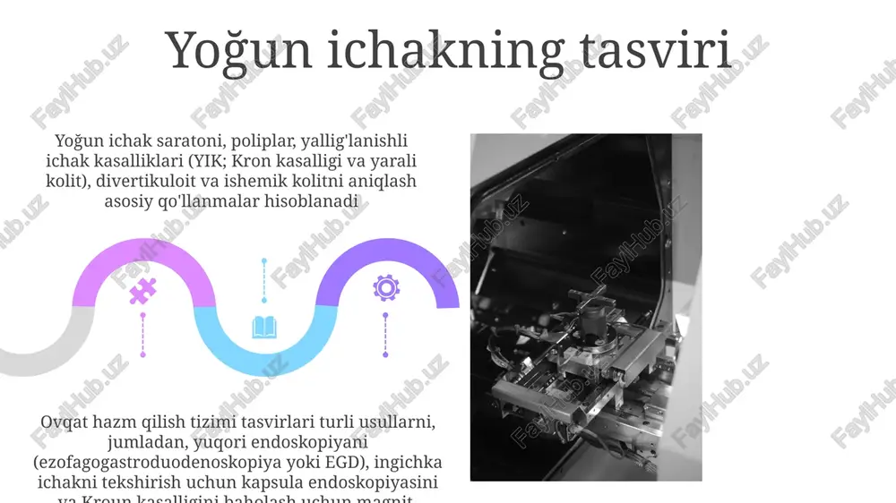 shiruvi oson mavjud, ichak devori qalinligini va suyuqlik to'planishini aniqlaydi e'tiboringiz uchun rahmat @taqdimot_robot image4.jpg image5.jpg image6.jpg image7.jpg image8.jpg image9.jpg image10.jpg image11.jpg image12.jpg image13.jpg image14.jpg image15.jpg image16.jpg image17.jpg image18.jpg image19.jpg image20.jpg image1.jpeg image2.jpeg image3.jpeg