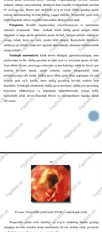 chambar ichak kasalliklari - Page 5