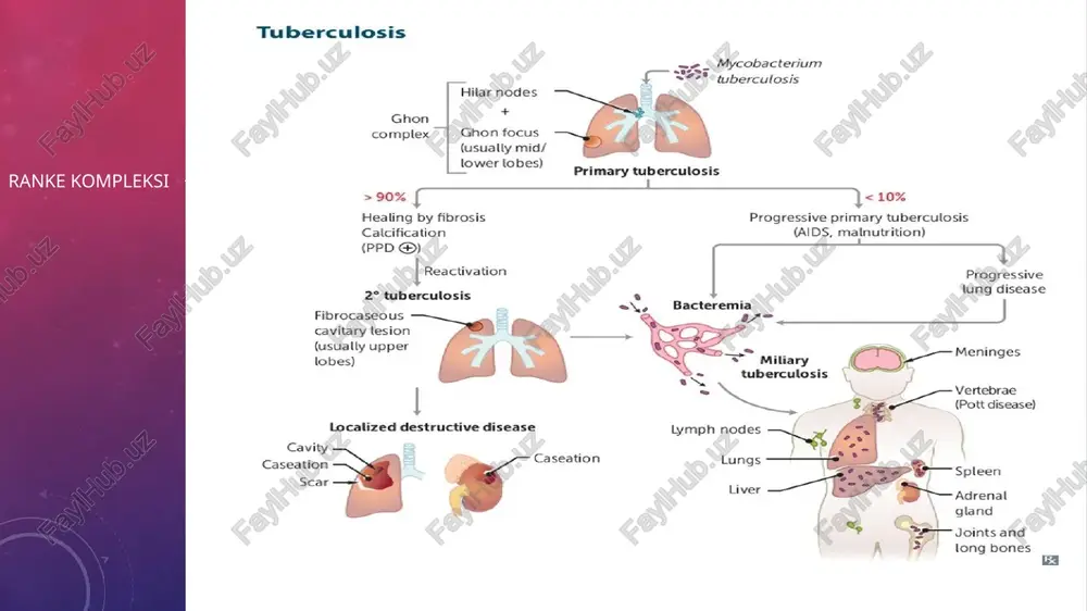 oki qo‘ziydigan davrida qon zardobida fibrinogen, antitripsin, sial kislotasi ko‘payadi, silga qarshi antitanalar titri va immunoglobulinlar ham oshadi. sil bronxoadenitining kichik ko‘rinishida o‘pka rasmining “buzilishi”, ildiz soyasining notekisligi, yurak o‘ng bo‘lagida o‘tmas burchak shakli, traxeya–bronx burchagining to‘lishganligi kuzatiladi. yaqqol turida esa o‘pka ildizi kattalashgan, chegarasi noaniq, qon tomirlar va yirik bronxlar soyasi ko‘rinmaydi. o‘sma shaklida esa tashqi chegaralar aniq, yallig‘lanish belgilari yo‘q. tomografiya yordamida kasallikni aniqlash osonlashadi. suri­lish davrida o‘pka ildizi chegaralari aniqlashib, o‘sma shakliga o‘xshaydi. qattiqlashish va kaltsinatsiya davrida o‘pka ildizi chandiqlashadi, plevra varag‘lari qalinlashadi, ko‘ks oralig‘i organlari kasal tomonga suriladi. kazeoz limfa tugunlarida kaltsiy tuzlari to‘planadi. bolalar va o‘smirlarda kaltsiy to‘plangan limfa tugunlari ko‘rinishi surunkali, uzoq davom etayotgan jarayonni bildiradi. asoratlari: kattalashgan limfa tugunlari bronxni ezib, atelektazga olib keladi. rentgenogrammada o‘pkaning qorong‘u sohasi ko‘rinadi, chegaralari aniq. rentgenoskopiyada diafragma paradoksal harakati, yurak va tomirlarning kasal tomonga surilishi (yakovson–goltsknixt belgisi) aniqlanadi. boshqa asoratlar: mediastinal plevra yallig‘lanishi, pleura qalinlashuvi yoki silning …