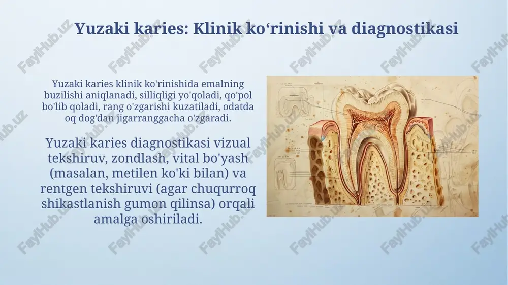 kariesning bosqichlari - Page 5