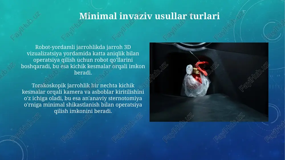 minimal invaziv yurak jarrohligi - Page 5