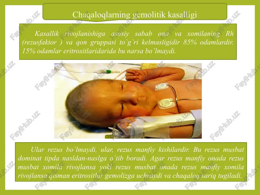 chaqaloqlar kasalliklari va ularni parvarish qilish - Page 5