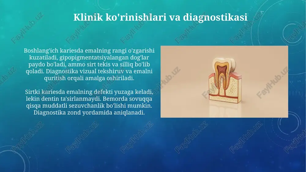 karies bosqichlari - Page 5
