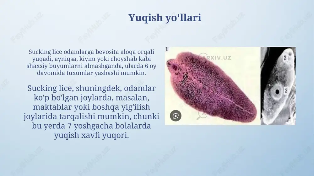 sorgichlilar -odam parazitlari - Page 5