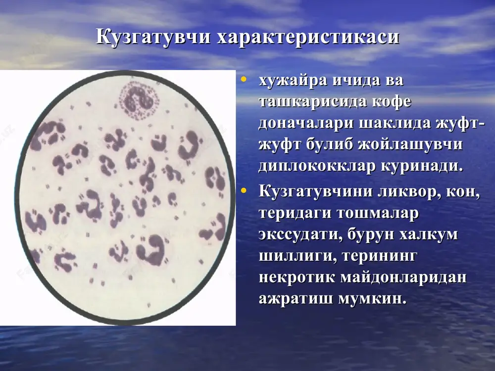 g klinik kurinishlari meningokokemiyaning ogirlik mezoni ogirlik buyicha: engil, urta ogir ogir shakli. ogirlik mezoni : toksikoz simptomning namoenligi xushning uzgarishi tana xaroratining darajasi gemorragik- nekrotik toshmaning kupligi va razmerlari meningokokkemiyaning yashinsimon kechadigan shakli - (uta utkir meningokokkli sepsis) kasallik utkir, tusatdan xarorat kutarilishi 39-40•s bilan boshlanadi, kaltirash, et uvishishi, kupgina gemorragik toshishi bilan namoenlanadi, katta kismiga kon kuyilish kuzatiladi, ab tushadi, kon aylanish etishmovchiligi, dvs,, mushaklar gipotoniyasi, talvasalanish rivojlanadi. bu shakl infektsion - toksik shok deb baxolanadi. adekvat va uz vaktida davo choralari olib borilmasa 12-24 soatdan keyin ulim yuzaga kelishi mumkin. kupincha bu kasallikning birinchi soatlarida buyrak usti bezida total kon kuyulishlaridan kelib chikadi (uoterxauz-_fridreksen sindrom). meningokokkemiyaning klinik kurinishi meningokokkemiyaning klinik kurinishi gemorragik toshmalar va uziga xos meningeal xolat. meningokokkli meningit kasallik kaltirash, tana xaroratini 39-40˚s kutarilishi bilan boshlanadi. bemorlar kasallikning kuni va soatini anik aytishi mumkin, kuchli bosh ogrishi, diffuz xarakterli kayt kilish, gipersteziyaga shikoyat kiladi, erta …