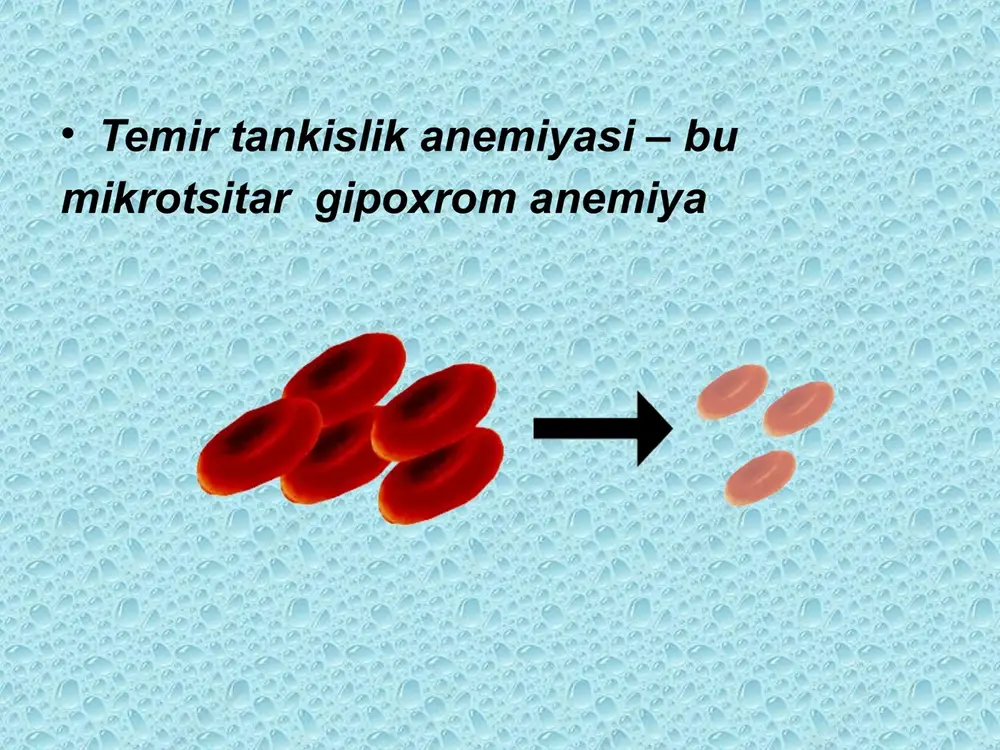 temir tanqislik anemiyasi - Page 5