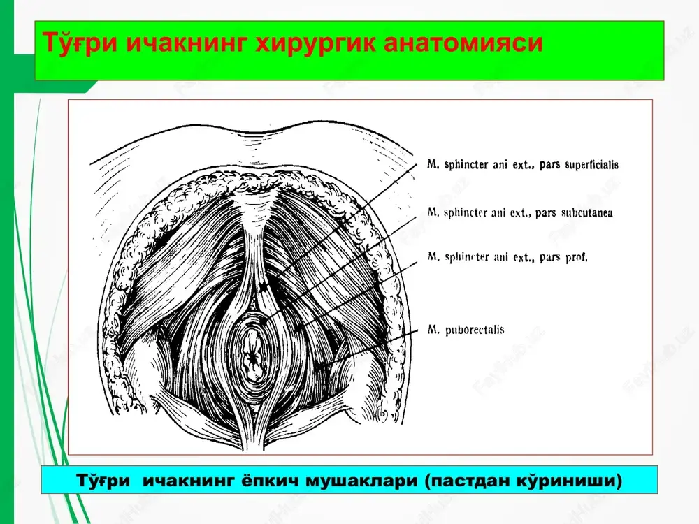 rks metodi buyicha bartaraf etish, oqma yo'lini teri tomonidan tsilindrsimon kesib olib tashlanadi. to'g'ri ichak tushishi to'g'ri ichakning tushishi deganda ichakning tashqariga orqa chiqaruv yo'li atrofiga chiqishi tushuniladi. qorin ichida bosimning oshishi (qabziyat, ich ketar, tug'ruk, yo'tal) ichak tushishiga sababchi hisoblanadi. dumba sohasi va bel-dumg'aza sohasining o'q otar qurollardan yaralanishi, maishiy shikastlar ham ichak tushishiga olib kelishi mumkin. to'g'ri ichak tushishi to'g'ri ichak tushishi va sfinkter etishmovchiligi to'liq - to'g'ri ichakning barcha qavatlari ag'dari-lib orqa chiqaruv teshigidan tushishi. noto'liq -to'g'ri ichak shilliq qavatining tushishi farq qilinadi (protsidentsiya). shilliq qavatining tushishi tushgan ichak shilliq kavatda o'tuvchi radial burmalar orqali engil aniqlanadi to'g'ri ichak tushishi eng oddiy davolash usuli bu - to'g'ri ichak atrofidagi mushaklarga yallig'-lanish chaqiruvchi dorilarni infil-tratsiyasi. to'g'ri ichak tushishi tushgan to'g'ri ichakni yig'ish va invaginatsiya yo'li bilan to'g'rilash sfinkter etishmovchiligi pickreil buyicha mushak plastikasi