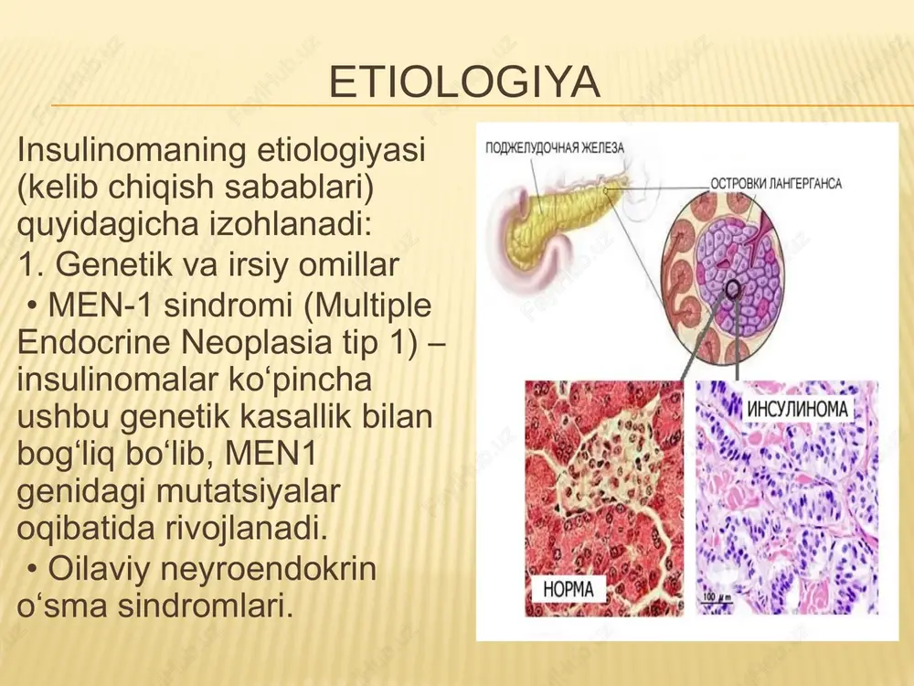 insulinoma tashxisi, etiologiyasi, patogenezi, klinikasi - Page 5