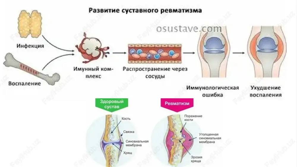 rekomendatsii vracha pri revmatizme. rolevaya igra na priyome u vracha - Page 5