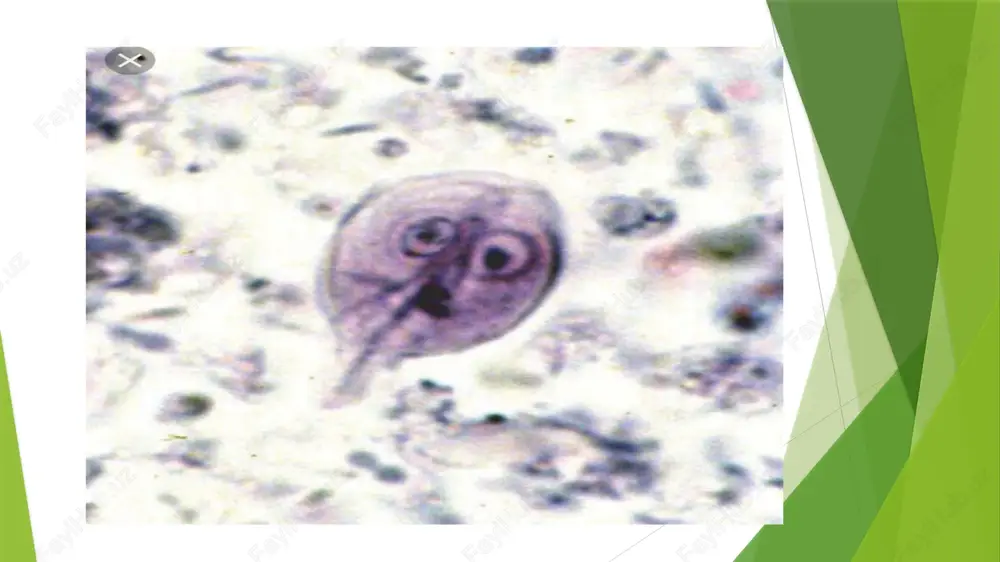 mlari ombor hona hodimlari kemuruvchilar bo’lgan honadonlarda va boshqa hollarda uchraydi kasallik patagenezi epidemik toshmali terlama kasalligiga o’hshash kasallikdan so’ng mikrobga va uning zahriga qarshi turg’un immunitet hosil bo;ladi qisman epidemik toshmali terlamaga ham immunited shakillanadi labaratoriya tashxisi hususiy diyagno’stikum bilan qo’yilgan aglutinatsiya reyaksiyasi o’tkaziladi bunda muzer antigeni bilan reyaksiyaning tipi poravachak antigeni bilan o’tkazilgan reyaksiya turiga nisbatan 3-4 barobar ortiq labaratoriya sharoitida keng qo’llanilgan va eng ishonchli usul komplementni bog’lash reyaksiyasi bunda komplementalni biriktiruvchi antitillolar bemor qonida kasalikning 6-7 kunidan boshlab aniqlanadi 14-16 kunga kelib titiri ortadi va kasallikning 20-27kunlarida eng yuqori darajaga yetadi epidemik toshmali terlamani endemik toshmali terlamadan farqlash uchun paravachak va muzer reketsiyalari antigenlari bilan strealogik testlar o’tkaziladi tamom image1.jpg image2.jpg image3.jpg image4.jpg image5.jpg image6.jpg image7.jpg image8.jpg image9.jpg /docprops/thumbnail.jpeg