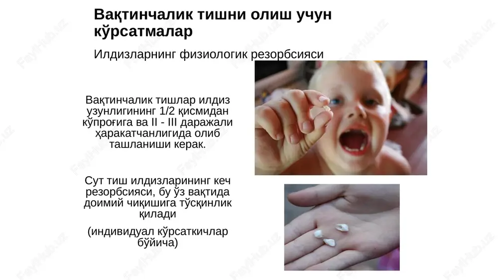 ii atipichnogo udaleniya zuba atipik tish olish operatsiyasini bajarish texnikasi obrazets teksta vtoroy uroven tretiy uroven chetvertiy uroven pyatiy uroven pryamim elevatorom udalyayut odinochnie korni zubov verxney chelyusti, imeyushie konicheskuyu formu, a takje raz'edinennie korni verxnix bol­shix korennix zubov. uglovoy elevator ispolzuyut dlya izvlecheniya korney nijnix zubov, v osnovnom molyarov. shtikovidniy elevator (elevator leklyuza). soedinitelniy sterjen elevatora shtikoobrazno izognut (ris. 6.8, g). rabochaya chast (shechka) imeet kopevidnuyu formu, sujaetsya i istonchaetsya k kontsevomu otdelu. odna poverxnost shechki gladkaya, drugaya — zakruglennaya. ruchka kruglaya, bolee tolstaya v sredney chasti, raspolojena perpendikulyarno po otnosheniyu k soedinitelnomu sterjnyu i rabochey chasti. za schet shtikovidnoyu izgiba prodolnaya os shechki i os soedinitelnogo sterjnya raspolojeni v parallelnix ploskostyax. elevator prednaznachen dlya udaleniya tretego nijnego bolshogo korennoyu zuba. 41 obrazets teksta vtoroy uroven tretiy uroven chetvertiy uroven pyatiy uroven pryamim elevatorom udalyayut odinochnie korni zubov verxney chelyusti, imeyushie konicheskuyu formu, a takje raz'edinennie korni verxnix bol­shix …