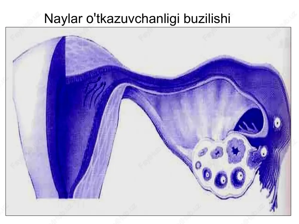 alar, tuxum hujayra va spermatazoid «probirkada» uchrashib bo'lg'usi onaga o'tkaziladi. bu usul bilan bepushtlik bilan kurashilmoqda. professionallar bu usulni ekstrakorporal uruglantirish (ot. extra — «tashqi», va corpus, corporis — «tana»); qisqa — eku deb atashadi. eku asosida tibbiyotda yangi yo'nalish paydo buldi. bu yo'nalish yordamchi reproduktiv texnologiyalar (yort). probirkada urug'lantirilgan bolalar oddiy bolalardan farq qilmaydi. ular xam kutilgan bolalar, shuning uchun ularni ota-onasi sevib parvarishlaydi. ular soglom bolishadi, agar kasal bo'lishsa, xuddi tengdoshlariday bo'ladi. «probirkadagi bolalar»? kimlar ular? qanaqa ular? induktsiya superovulyatsiyasi (tuxumdonlar gormonal stimulyatsiyasi bir emas bir nechta tuxumni etishtirish) eko uchun sharoit xisoblanadi. eko bu naylar bepushtligini davolash uchun tanlangan bo'lib bugungi kunda bepushtlikning barcha turlari shu usul orqali davolash mumkin. ekoga ko’rsatma eko va eko etaplari. eku – ekstrokorparal urug'lantirish. tuxum xujayraning ayol organizmidan tashqarida – «probirkada» urug'lantirish. etaplari: superovulyatsiya induktsiyasi tuxum xujayrani uruglantirish va embrionlar kultivatsiyasi follekulyar punktsiyasi va tuxum xujayrani olish; bachadon bo'shlig'iga embrionlarni o'tkazish …