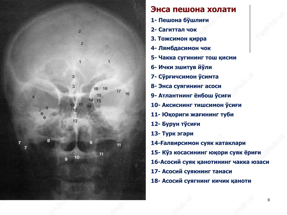 kalla suyagi va umurtqa pog'onasi kompleks nur diagnostikasi - Page 9