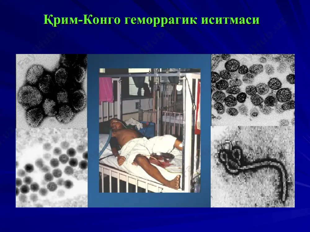 қрим-конго геморрагик иситмаси - Page 2