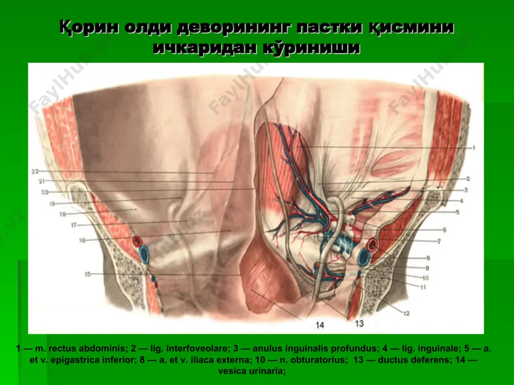 чов, сон, киндик ва қорин оқ чизиғи чурралари - Page 3