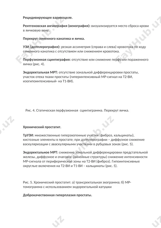льное мрт: снижение зональной дифференцировки предстательной железы, диффузное и очаговое (линейные структуры) снижение интенсивности мр-сигнала от периферической зоны на т2-ви (фиброз). гипоинтенсивные округлые включения на т2-ви и т1-ви – кальцинаты (рис. 5). рис. 5. хронический простатит: а) трансректальная эхограмма; б) мр-томограмма с использованием эндоректальной катушки доброкачественная гиперплазия простаты. трузи, мрт: увеличение железы, изменение формы; нарушение зонального строения за счет увеличения центральной области железы, выпячивание парауретральной части в полость мочевого пузыря. динамическое контрастное усиление при мрт: медленное накопление (несколько минут) и медленное вымывание кв. рак простаты. трузи, эндоректальная мрт: локальное снижение эхогенности (интенсивности мр-сигнала) от периферической зоны, ассиметричное нарушение зональной архитектоники железы. при трузи – деформация сосудистого рисунка ткани железы, при мрт – признаки инвазии в парапростатическую клетчатку, семенные пузырьки, шейку мочевого пузыря, прямую кишку; признаки регионарной и нерегионарной лимфаденопатии, метастазирование в кости(рис. 6). динамическое контрастное усиление при мрт: резкое накопление кв в первые 10 сек артериальной фазы и последующее медленное …