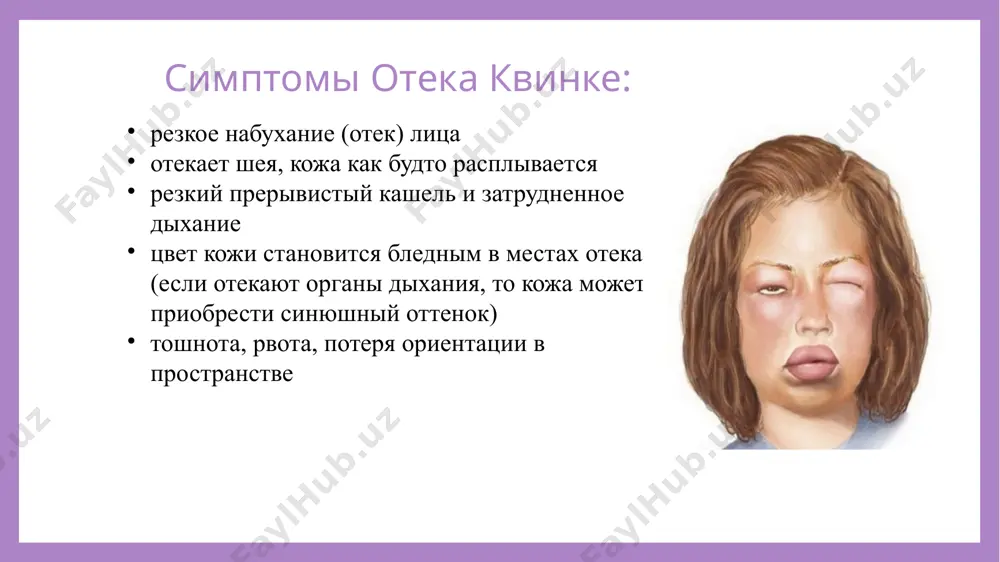 rugogo antigistaminnogo preparata. esli net vozmojnosti vvesti preparat vnutrimishechno, nujno polojit tabletku bolnomu pod yazik. spasibo za vnimanie! budte ostorojni i beregite svoe zdorove! image1.png image2.png image3.png image4.png image5.png image6.png image7.png image8.png image9.png image10.png image11.png /docprops/thumbnail.jpeg
