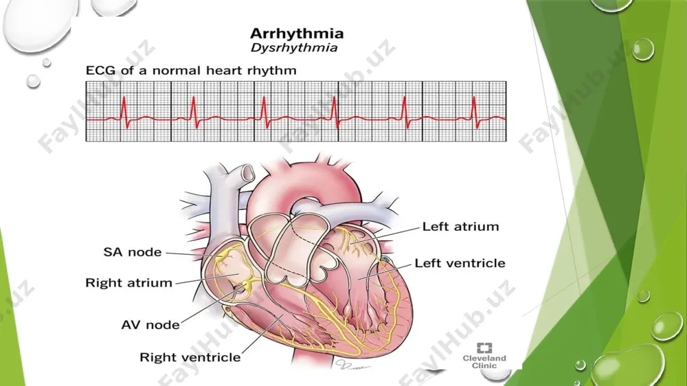 hаsi vа qrs-t kоmpleksi ketmа-ketligi) sаqlаngаn. r-r оrаlig‘ining fаrqi 0,15 s dаn oshadi. nаfаs ushlаb turilgаndа аritmiya belgilаri yo‘qоlаdi. image2.jpeg image1.png image3.jpeg image4.jpeg image5.jpeg image6.jpeg image7.jpeg /docprops/thumbnail.jpeg