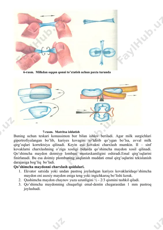 fantomlarda ii sinf karioz bo‟shliqlarini charxlash va plombalash - Page 4